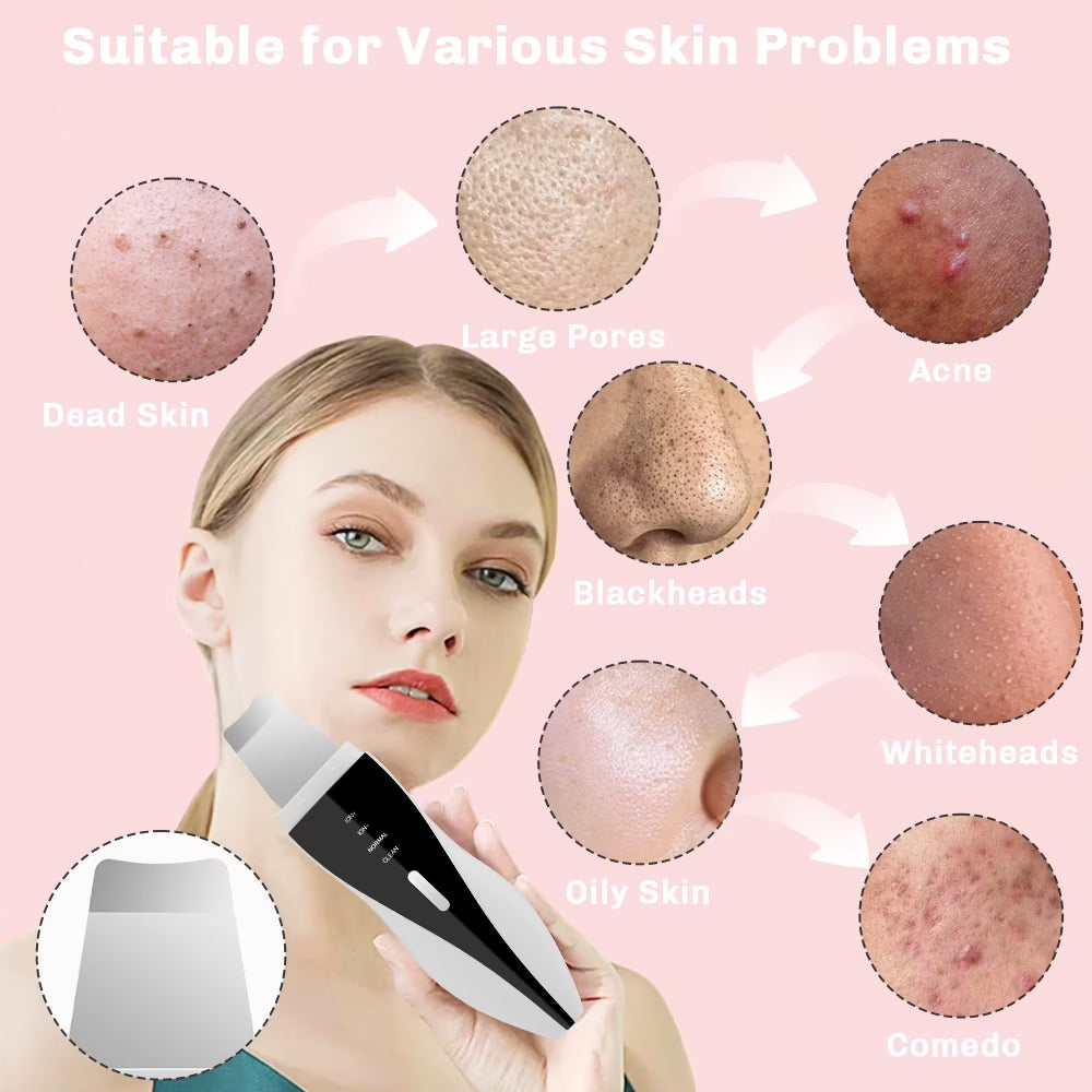 Skin Scrubber Face Spatula, Ultrasonic Black Head Remover for Face with 4 Modes Facial Shovel Cleanser Lifting Skin Care Tools with USB Charger