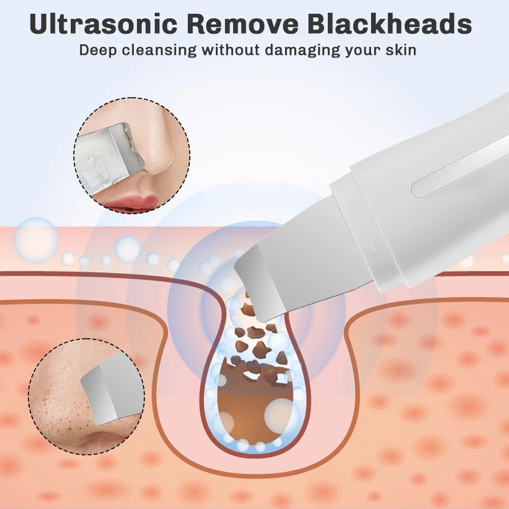 Skin Scrubber Face Spatula, Ultrasonic Black Head Remover for Face with 4 Modes Facial Shovel Cleanser Lifting Skin Care Tools with USB Charger