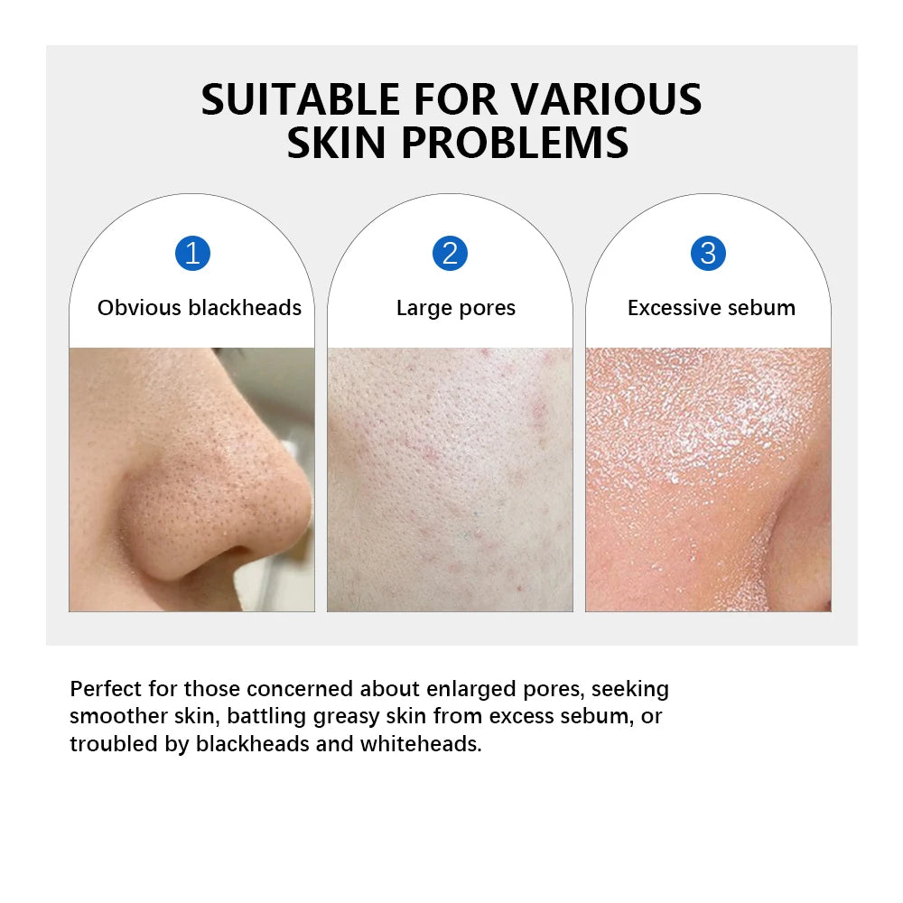 4.5% AHA Lactic Acid & 0.45% BHA 0-Pore Toner Pad Salicylic Acid Dual-Textured Facial Toner Pads for Exfoliation and Pore Care